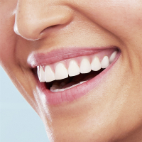 Електрична зубна щітка Oral-B Vitality D100.413.1 Sens Clean 3710 (4210201234227) Diawest
