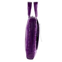 Сумка для ноутбука Continent 10-11'' (CC-071 Violet) Diawest